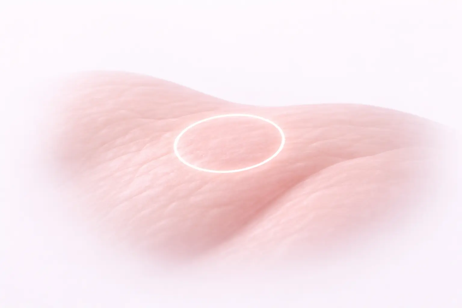 A 3D medical illustration showing a smooth tissue surface with a highlighted area for precise surgical excision